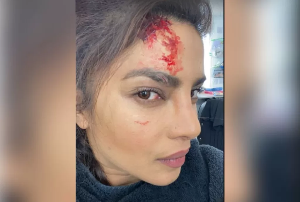 Priyanka Chopra shares a blood stained selfie from the sets