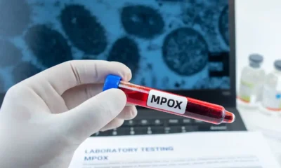 Kerala mein 38 saal ka aadmi Mpox Positive Paya Gaya